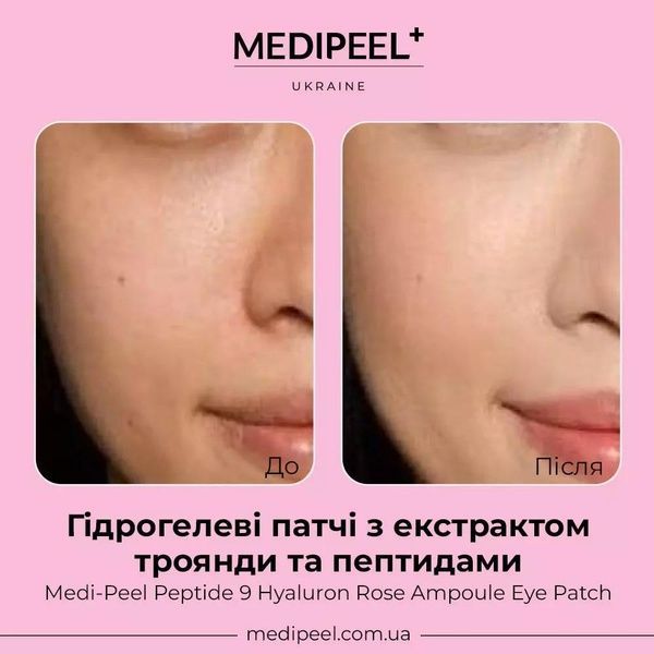 Гідрогелеві патчі з екстрактом троянди та пептидами Medi-Peel Peptide 9 Hyaluron Rose Ampoule Eye Patch, 60 шт 6cb-34b фото