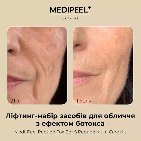 Набір антивікових засобів для обличчя Medi-Peel Bor-Tox 5 Peptide Multi Care Kit 00a-1ab фото
