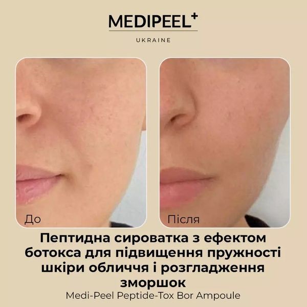 Сироватка для обличчя пептидна з ефектом ботокса Medi-Peel Peptide-Tox Bor Ampoule, 30 мл 882-582 фото