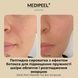 Сироватка для обличчя пептидна з ефектом ботокса Medi-Peel Peptide-Tox Bor Ampoule, 30 мл 882-582 фото 3