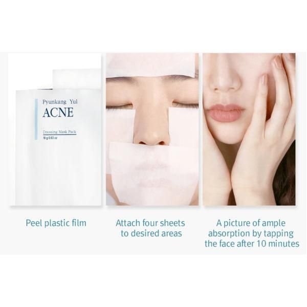 Тканевая маска для проблемной кожи Pyunkang Yul ACNE Dressing Mask Pack 18 г 41a-0i2 фото