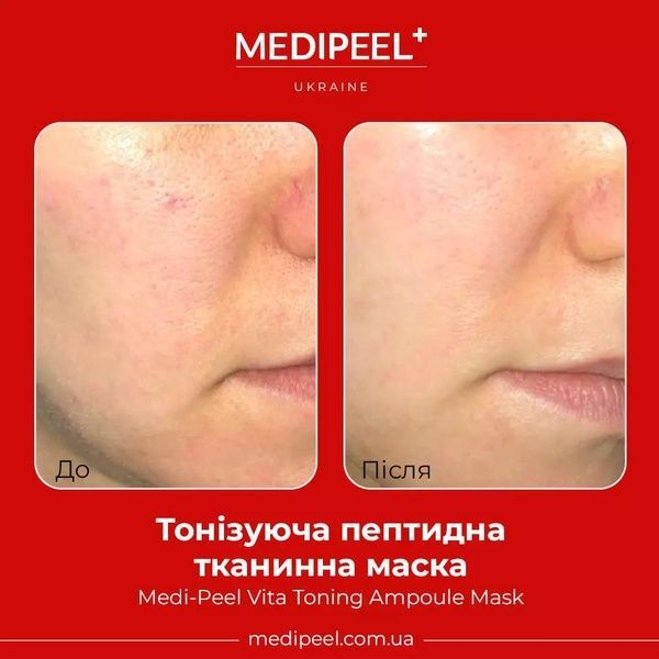 Тонізуюча ампульна маска Medi-Peel Vita Toning Ampoule Mask 30 мл b7c-262 фото