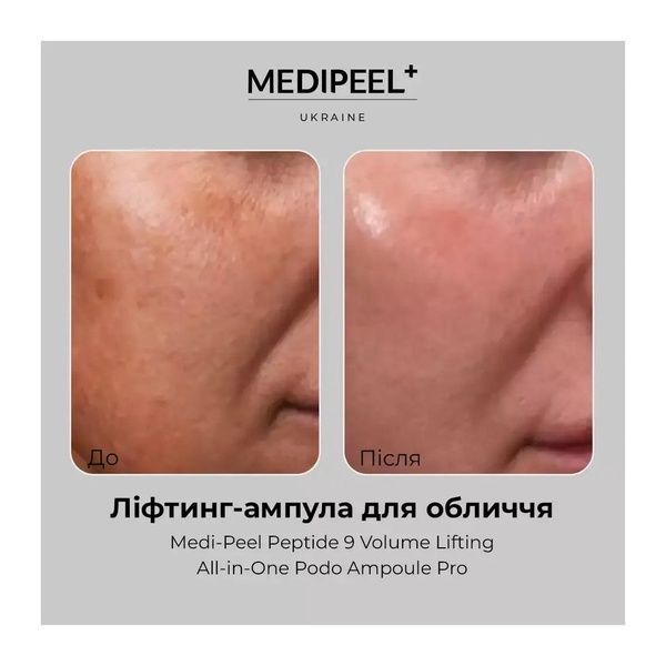 Ліфтинг-сироватка Medi-Peel Peptide 9 Volume Lifting All-in-One Podo Ampoule Pro 30 мл b75-917 фото