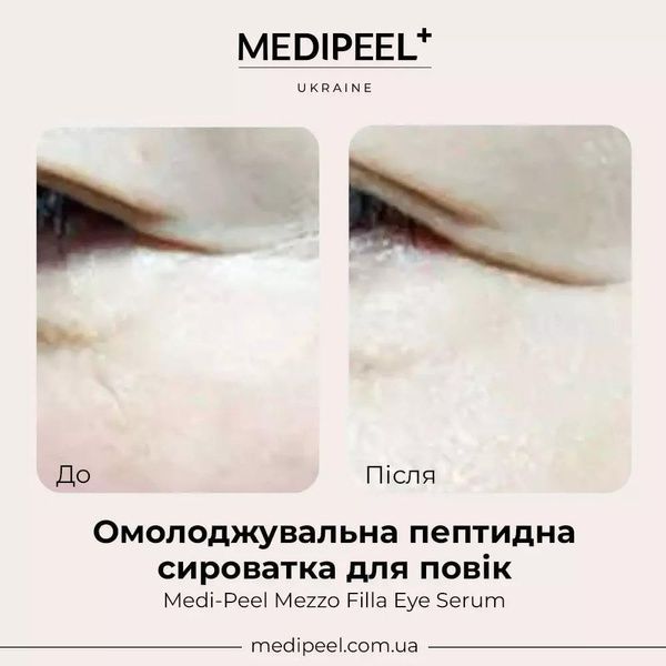 Лифтинг-сыворотка для кожи вокруг глаз Medi-Peel Mezzo Filla Eye Serum 30 мл 915-713 фото