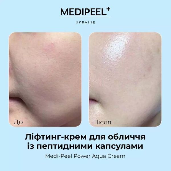 Крем для лица капсульный увлажняющий Medi-Peel Power Aqua Cream с пептидами 50 мл 260-90c фото