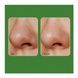 Пилинг-маска с микроиглами для проблемной кожи Medi-Peel EGF Peel Tox, 70 г 034-ac4 фото 3