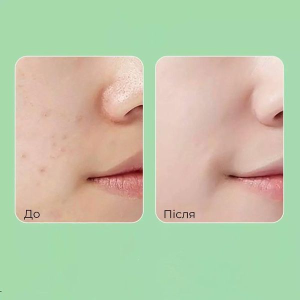 Пілінг-скатка з кислотами Medi-Peel Phyto Cica-Nol B5 AHA BHA Vitamin Calming Peeling Gel 120 мл 600-842 фото