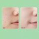 Пілінг-скатка з кислотами Medi-Peel Phyto Cica-Nol B5 AHA BHA Vitamin Calming Peeling Gel 120 мл 600-842 фото 2