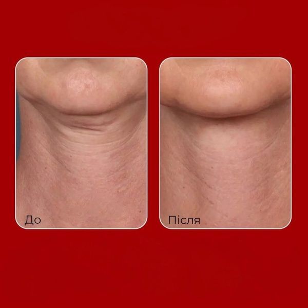 Подтягивающий пептидный крем для шеи и декольте Medi-Peel Premium Collagen Naite Thread Neck (2.0) 100 мл 76b-a65 фото