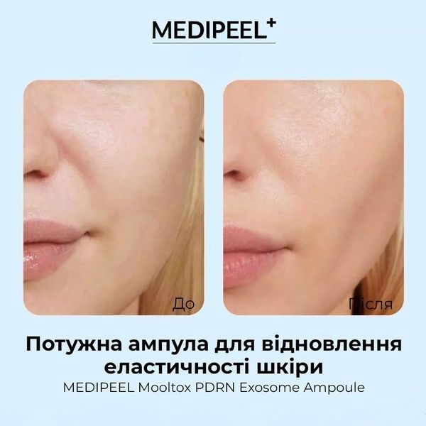 Сыворотка для восстановления эластичности кожи Medi-Peel Mooltox pdrn Exosome Ampoule 50 мл 8c4-14c фото