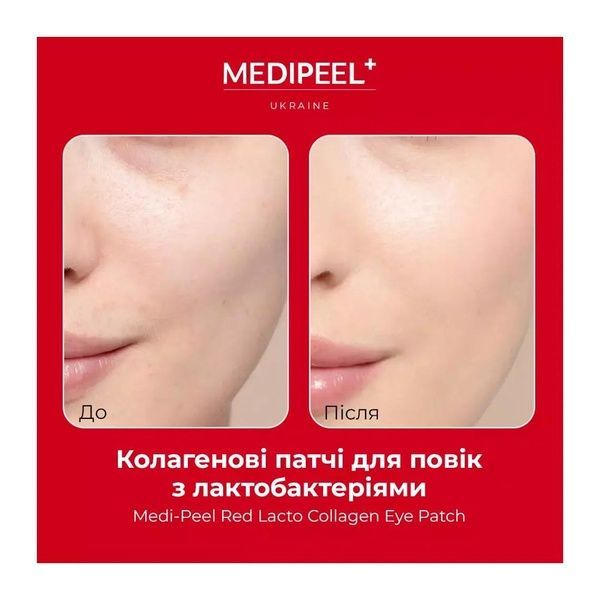 Патчи для кожи вокруг глаз омолаживающие Medi-Peel Red Lacto Collagen Eye Patch с коллагеном, 60 шт 31c-i2i фото