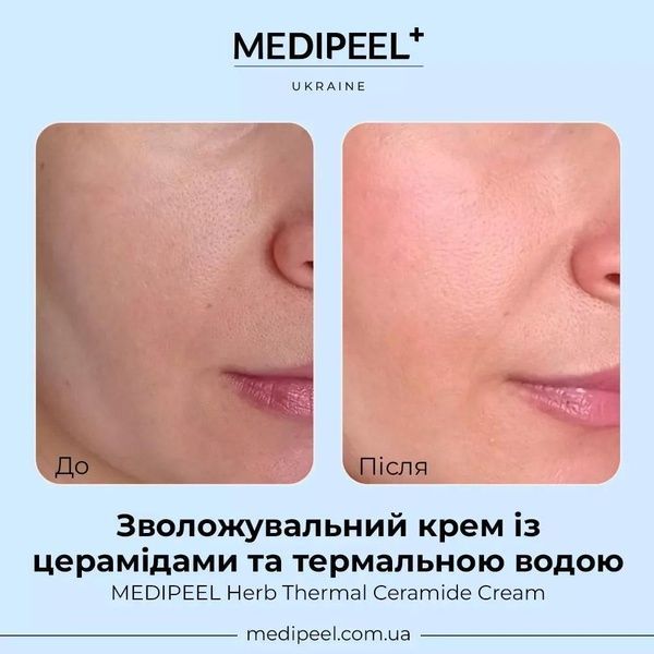 Крем зволожувальний із керамідами та термальною водою Medi-Peel Herb Thermal Ceramide Cream, 120 мл 18c-399 фото