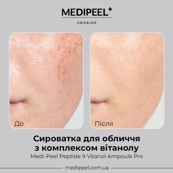 Сироватка для обличчя з комплексом вітанолу Medi-Peel Peptide 9 Vitanol Ampoule Pro, 30 мл 043-9ca фото